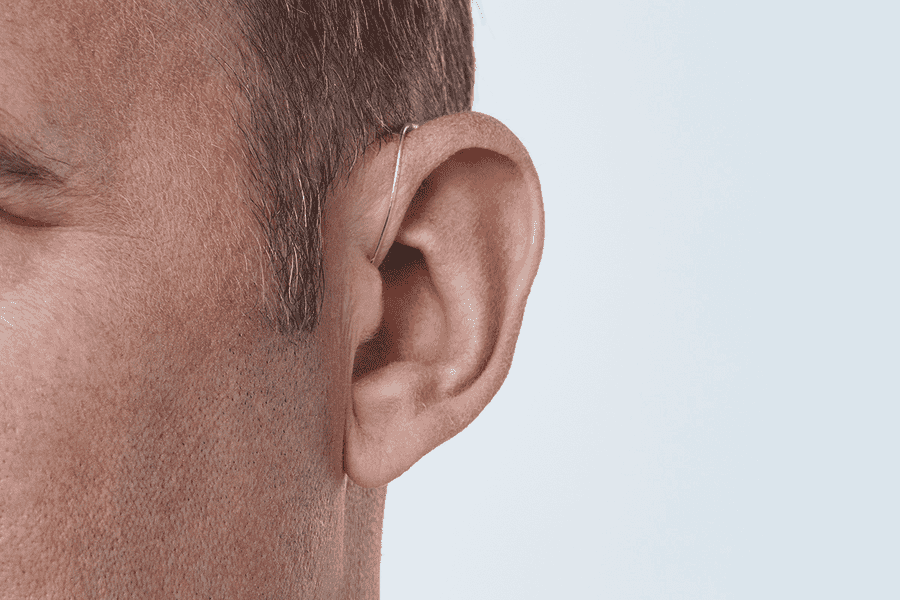 Oticon Intent - Migelino